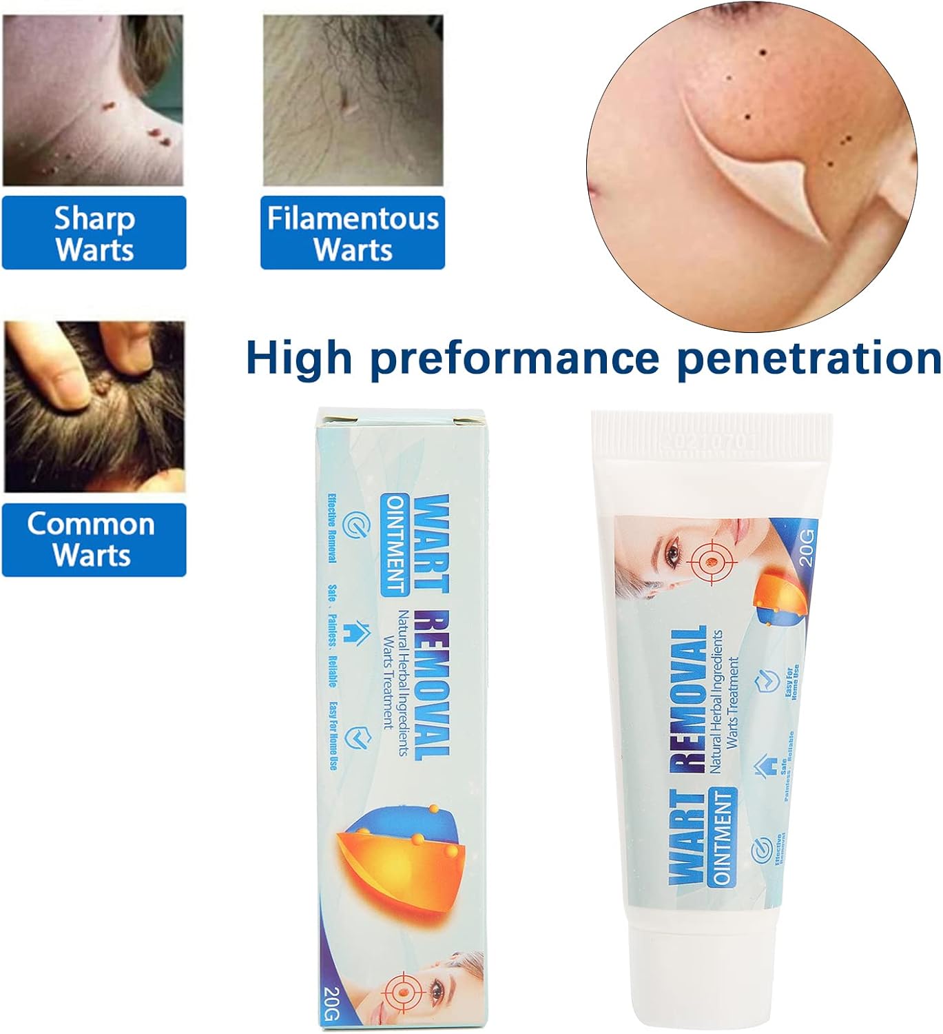 Cirugía Láser De Verruga Plantar O Papiloma En Donostia - Foto 14