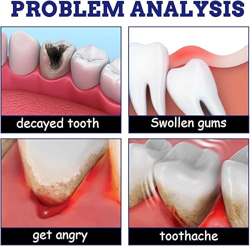 Miniatura 3 de Spray para aliviar el dolor de dientes para adultos, tratamiento para el dolor del nervio del dolor de dientes, Quicklynumbs Inflamación de la muela