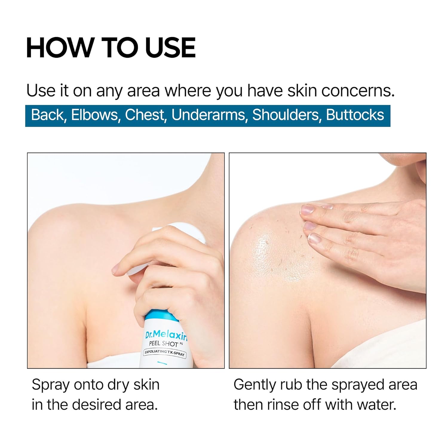 Dr.Melaxin TX Peel Shot Body Exfoliating Spray with Tranexamic Acid & Niacinamide, Brightening Body Care for Uneven Skin Tone, 200ml