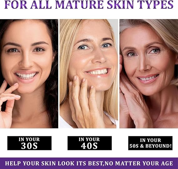 EPIGLOW MelanEX Advanced Anti-Hyperpigmentation Cream,20g MelanEX Advanced Anti-Hyperpigmentation Cream, Fast-Absorbing Facial Skin Lifting Lotion For Daily Use Night Routine