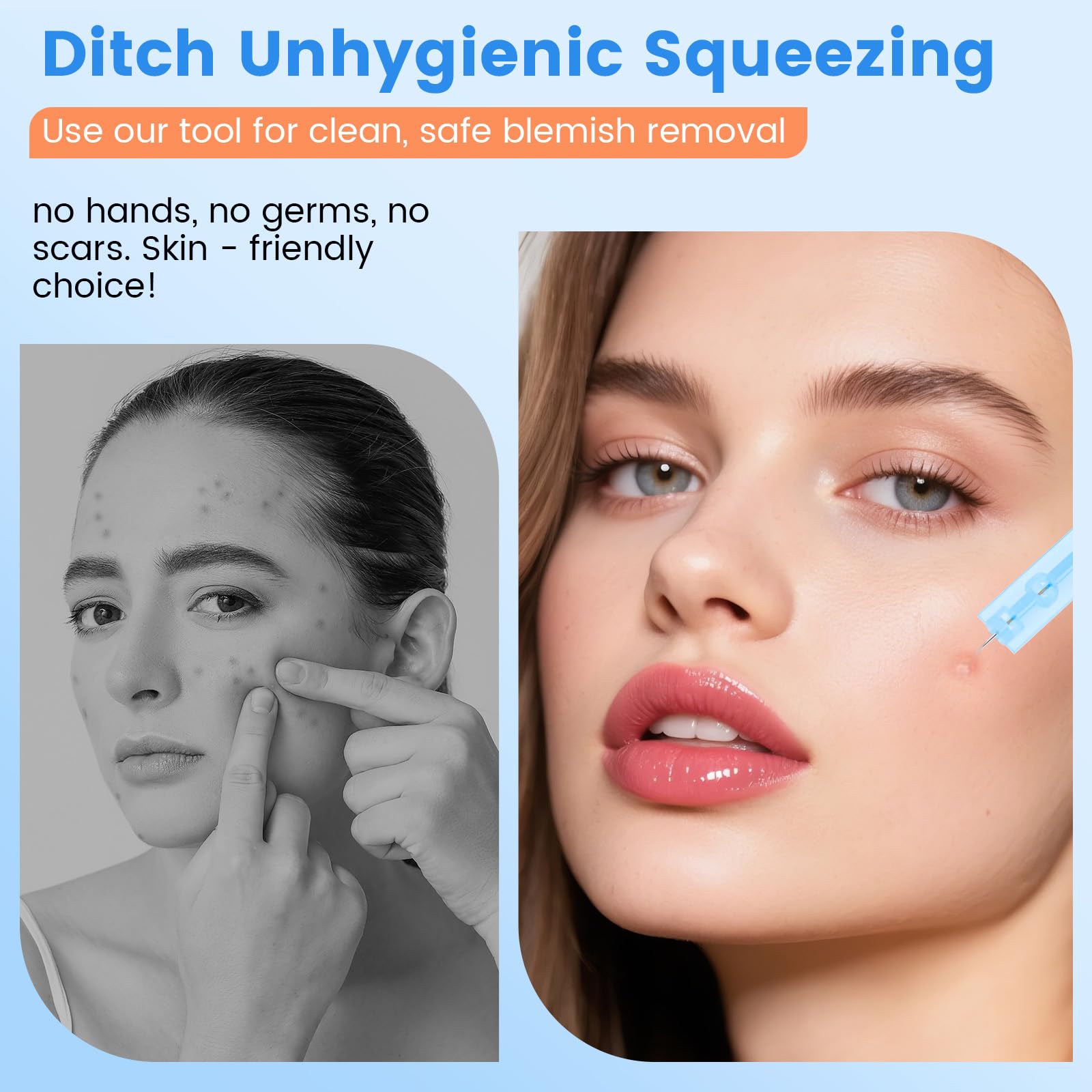 100 Blemish Remover Acné Aguja - Desechables Eliminar Espinillas, Removedor de Puntos Blackhead con 108 Parches Puntuales, Afilado Desechable Blackhead para Limpiador Granos