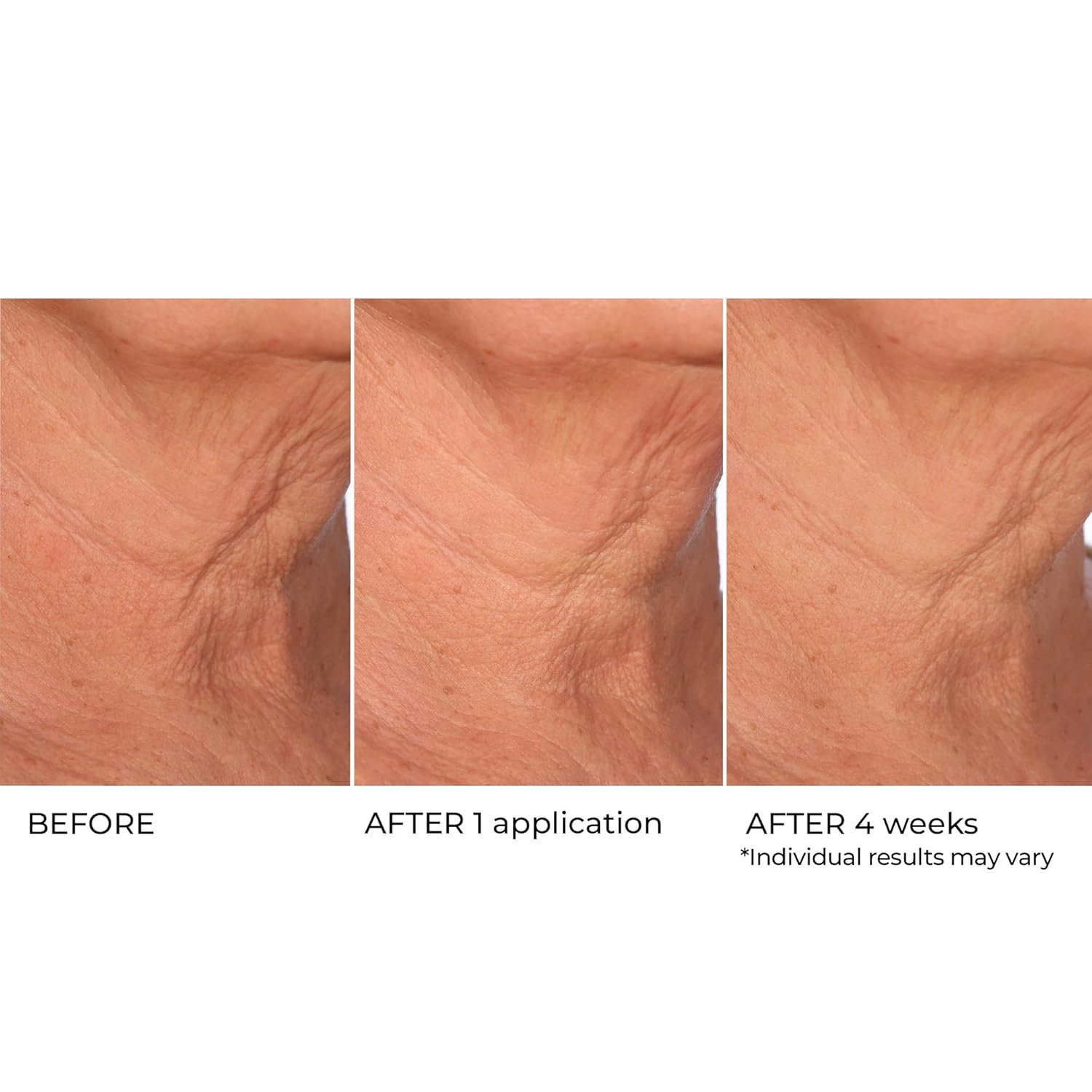 NassifMD Age Defying Neck & Décolleté Serum, Lifts and Firms Thin Neck Skin, Hydrates and Smooths - Image 4