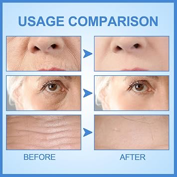 3Pcs Stock Solution Facial Serum, Face Serum Collagen Serum for Face, Anti-Aging Serumto Reduce Wrinkles & Fine Lines, Boost Skin Elasticity, Hydrate & Plump for All Skin Types
