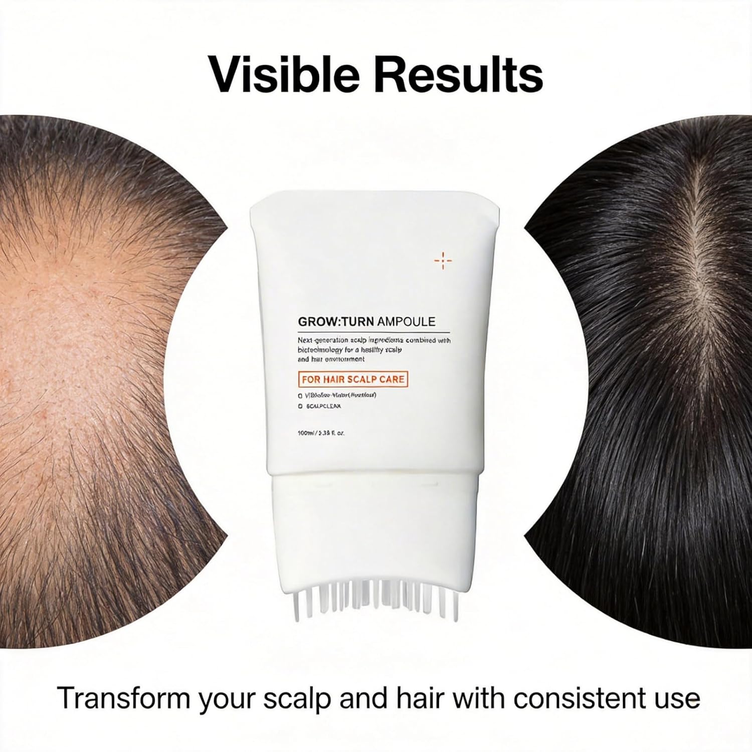 Yuki Hair Growth Serum with Built-in Scalp Brush,Heartleaf-Derived Exosomes,Scalp Massager for Gentle Hair Care,3.38 fl. oz