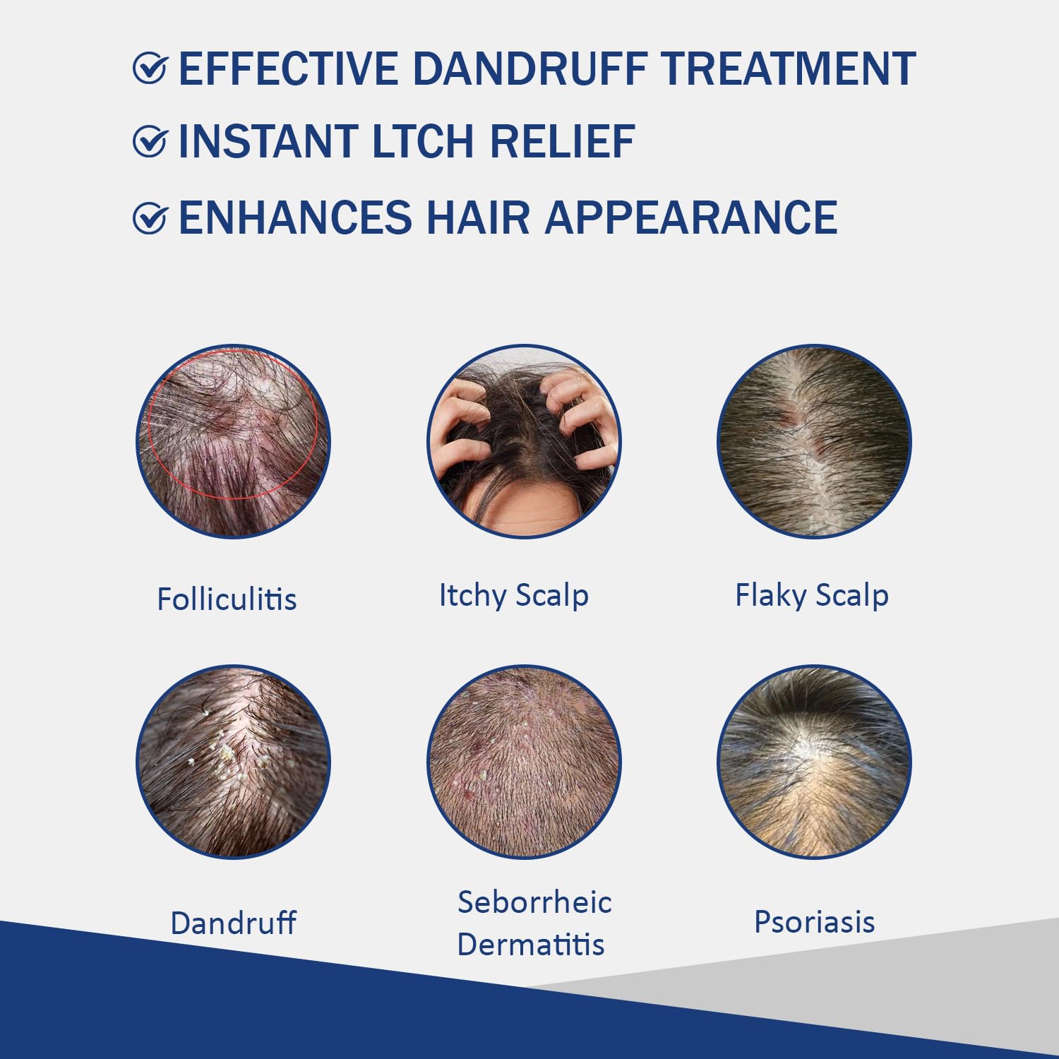 Sulfate Free - Anti Fungal Folliculitis Treatment Shampoo With Formula for Prone to Folliculitis,Seborrheic Dermatitis,For Normal to Oily Scalp Relieves Itchy & Dry Scalp, Dandruff - 10.1 Oz - Image 3