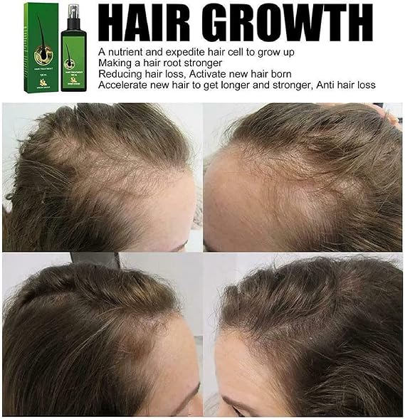 Hair Growth Serum & Lotion 2 Pack for Men & Women - Hair Root & Beard Growth with Roller + Ginger Shampoo Soap