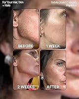 Vista 3 de BeMe Colágeno Líquido para Mujeres - 2500mg de Colágeno Verisol Líquido con Biotina, CoQ10 y Vitamina C - Péptidos de Colágeno Clínicamente Probados