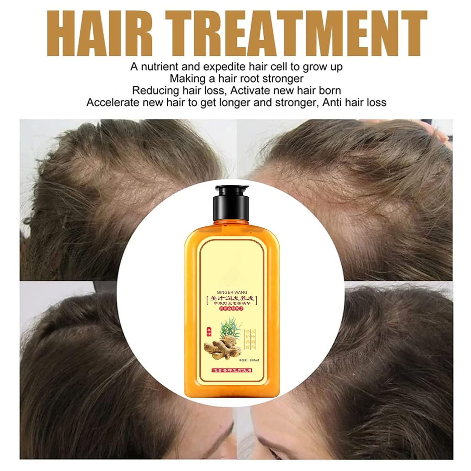 Ginaday Instant Ginger Hair Regrowth Shampoo, Ginger Shampoo for Hair Growth, Ginger Hair Care Shampoo, Ginger Anti-Hair Loss Hair Shampoo (280ML/1PCS) : Beauty & Personal Care