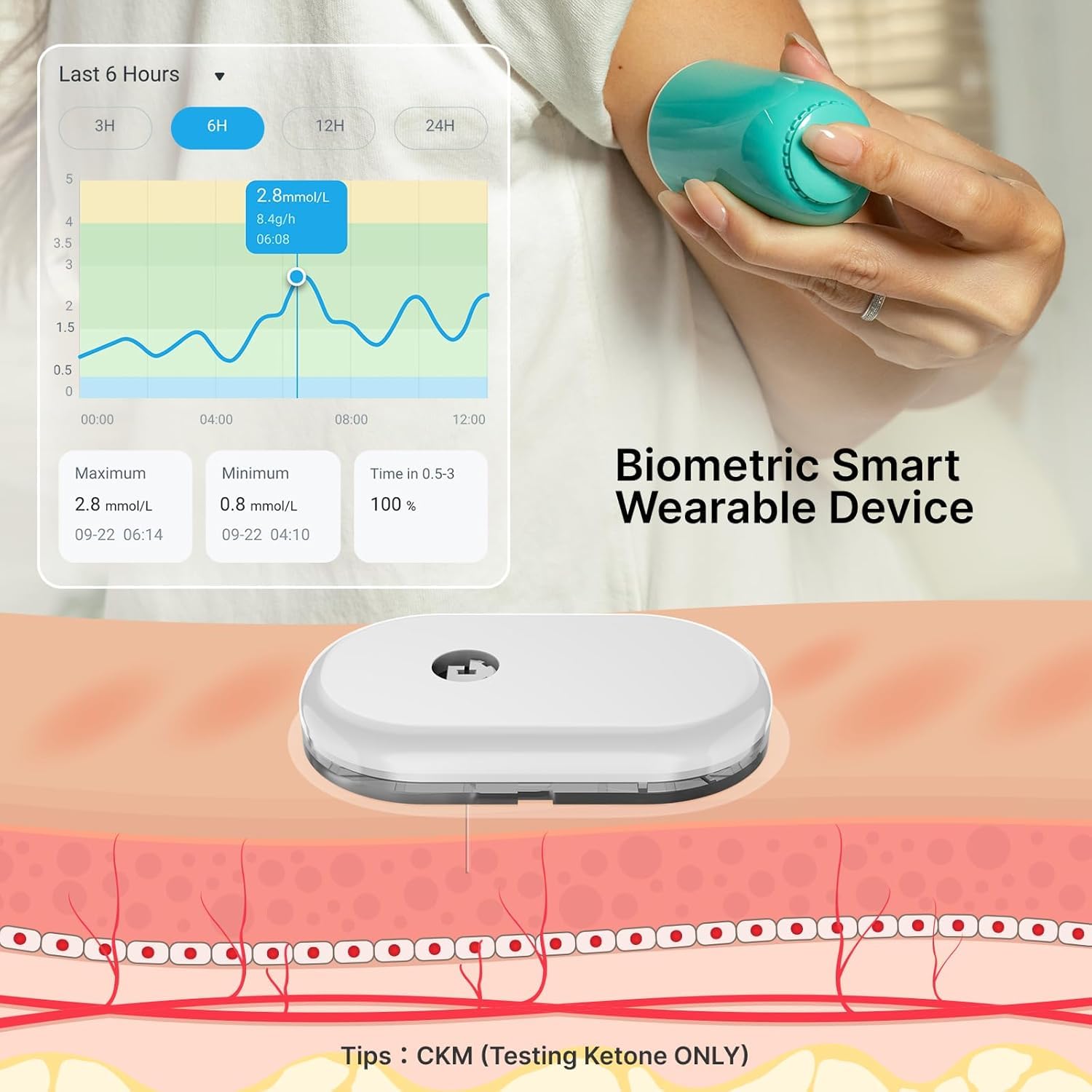 SiBio KS1 Continuous Ketone Monitoring