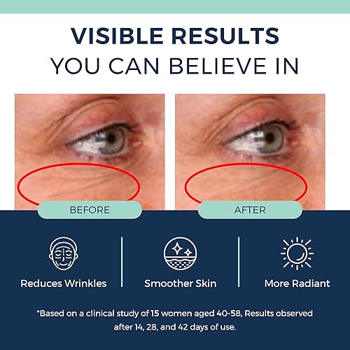 Miniatura 5 de Suero de colágeno con retinol antienvejecimiento para rostro retinol encapsulado al 1%, niacinamida y ácido hialurónico, mejora las arrugas, la