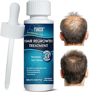 60ML Sérum Croissance des Cheveux, Stimule la Pousse, Soin Cheveux, Pour Adulte Clairsemés