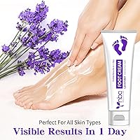 Vista 6 de Removedor de callos para pies, crema para manos y pies, loción para piel extremadamente seca, tratamiento de pies de atletas, productos de spa