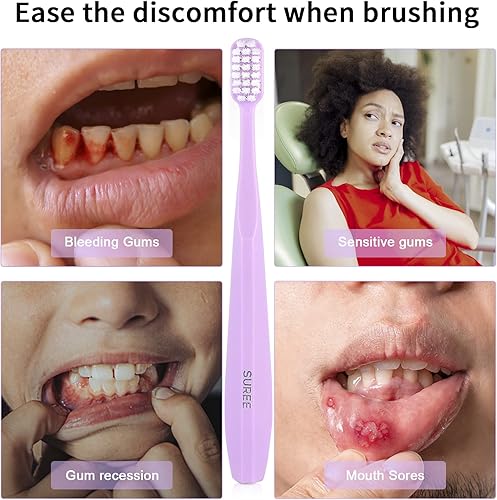 Miniatura 6 de SUREE Cepillo de dientes extra suave para dientes y encías sensibles (paquete de 5), cepillo de dientes ultra suave con 10000 micro cerdas nano para