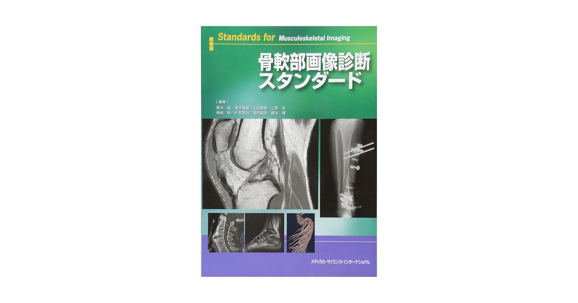 症例の比較で学ぶ画像診断骨軟部50選 (29-4) (画像診断 09年臨時増刊号) 福田 国彦 骨軟部画像診断スタンダード | 青木純, 青木隆敏, 上谷雅孝
