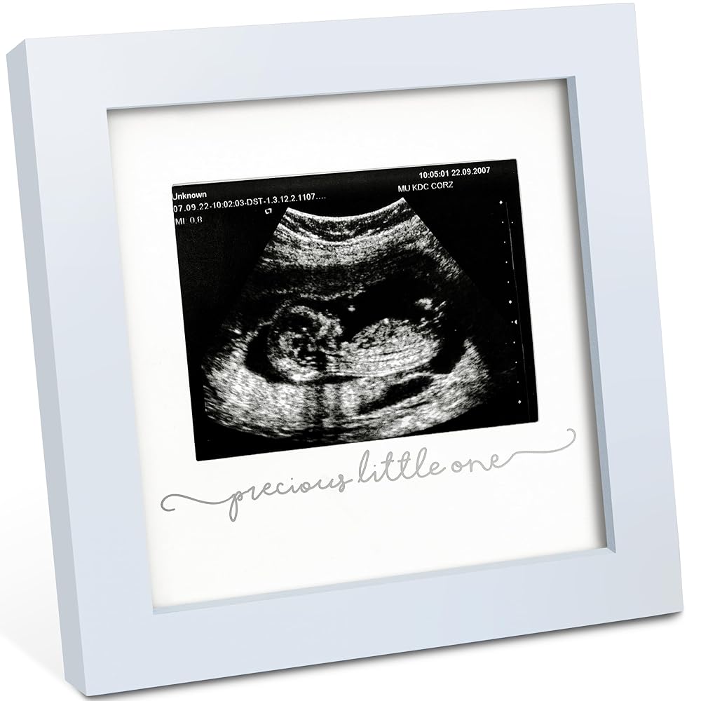 KeaBabies Baby Sonogram Picture Frame - Modern Ultrasound Picture Frames for Mom to Be, First Pregnancy Gifts for Expecting Mom & First Time Dad, Baby Gender Reveal Gifts(Mist Blue)