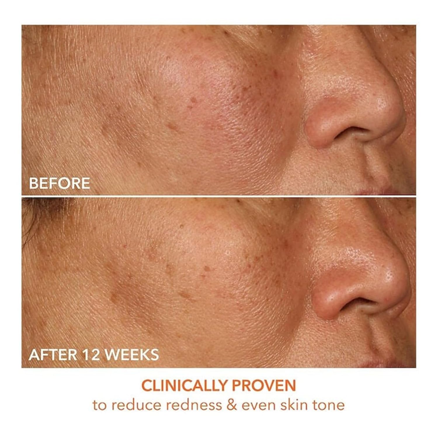 Dr Dennis Gross Vitamin C Lactic 15% Firm & Brighten Serum - Image 5