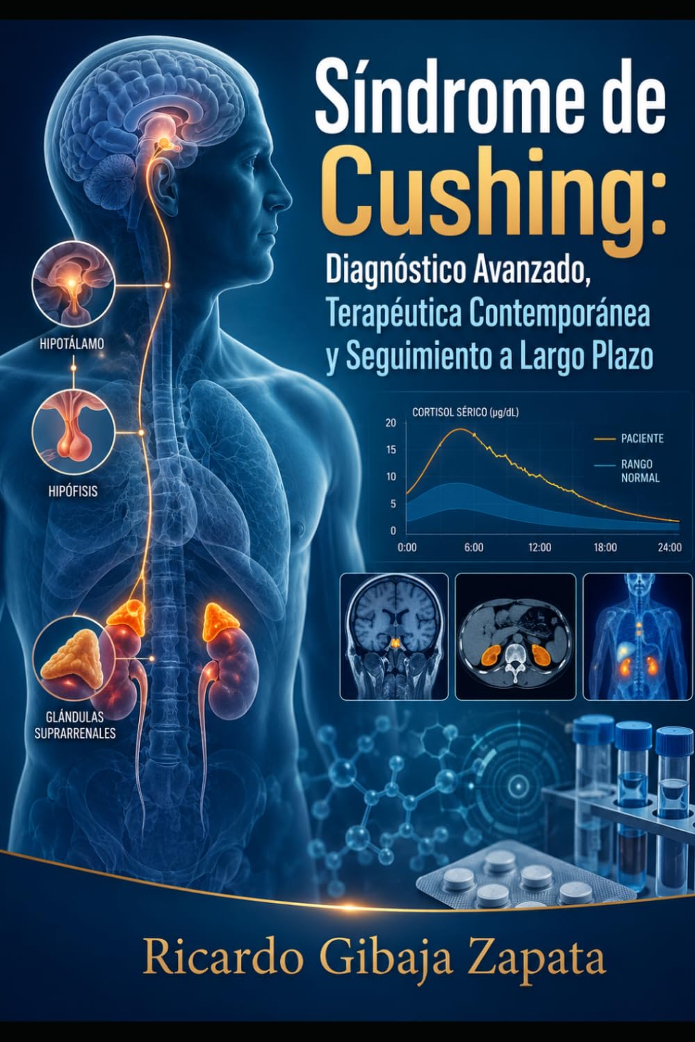 Síndrome de Cushing: Diagnóstico Avanzado, Terapéutica Contemporánea y Seguimiento a Largo Plazo
