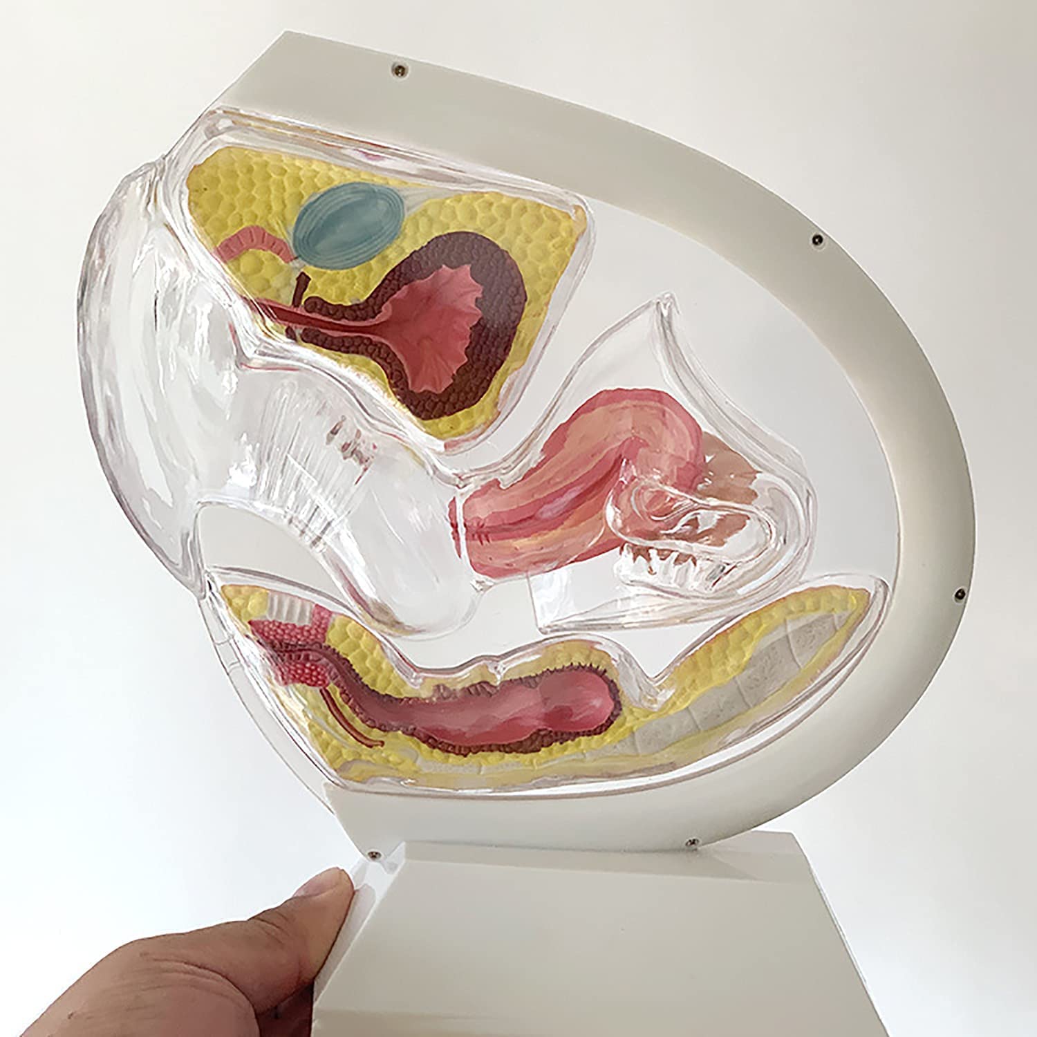 Transparentes Uterus-Modell Demonstration des Menstruationstassen-Verhütungslehrmodells Fortpflanzungsorgan Anatomisches Modell des Uterinen Fortpflanzungssystems des Becken-Eierstocks