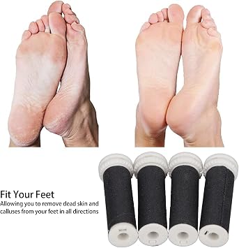 Yosoo Health Gear 4pcs Refill Rollers for Callus Remover, Electric Foot File Grinder Replacement Head Grinding Tool for Feet Pedicure