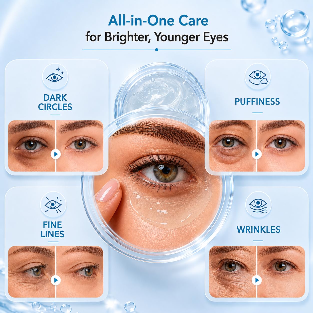 Aureva Under Eye Cream For Dark Circles For Men & Women | Reduces Dark Circles, Puffiness, Wrinkles, Pigmenation (20 mL) 2