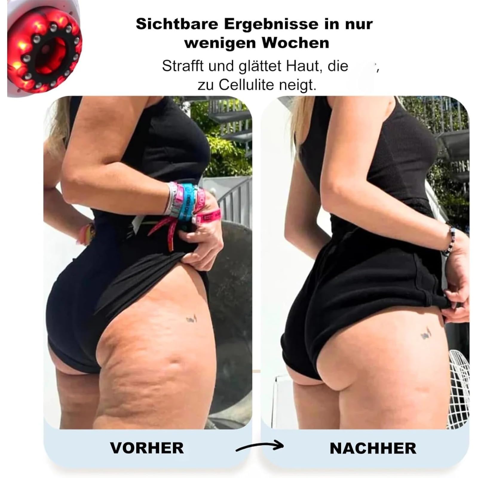 Vacuvia SculptGlow 4-in-1Appareil Anti-Cellulite – Massage par Ventouse et Palper-Rouler pour – Raffermit la Peau d’Orange sur Cuisses, Ventre et Fesses (Doré)