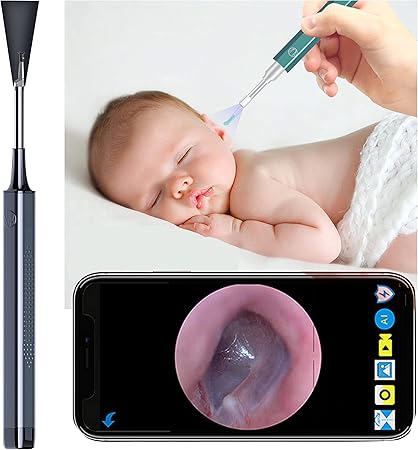 Amazon Co Jp 耳かき カメラ ワイヤレス イヤースコープ 耳掃除 耳かきワイヤレス イヤースコープ Tik Tok 光る耳かき ライト付耳かき 極細レンズ3 5mm Ip67防水 700万画素 Wifi接続 Type C充電式 スマホ タブレット対応 お年寄り 子供 耳垢クリーニング 耳掻き セット Amazon Co Jp 耳かき カメラ ワイヤレス イヤースコープ 耳掃除 耳かきワイヤレス イヤースコープ Tik Tok 光る耳かき ライト付耳かき 極細レンズ3 5mm Ip67防水 700万画素 Wifi接続 Type C充電式 スマホ タブレット対応 お年寄り 子供 耳垢クリーニング 耳掻き セット