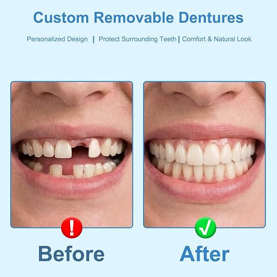 Partial Dentures for Men & Women (Six Teeth)