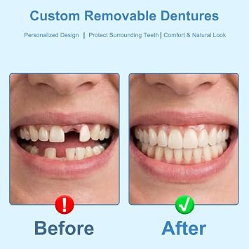 Partial Dentures for Men & Women (Six Teeth)