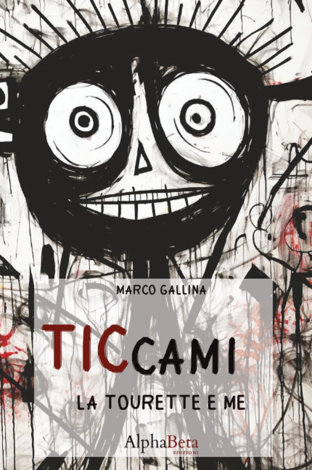 La Tourette e Me: Ticca fuori dal coro! (Ticcami)
