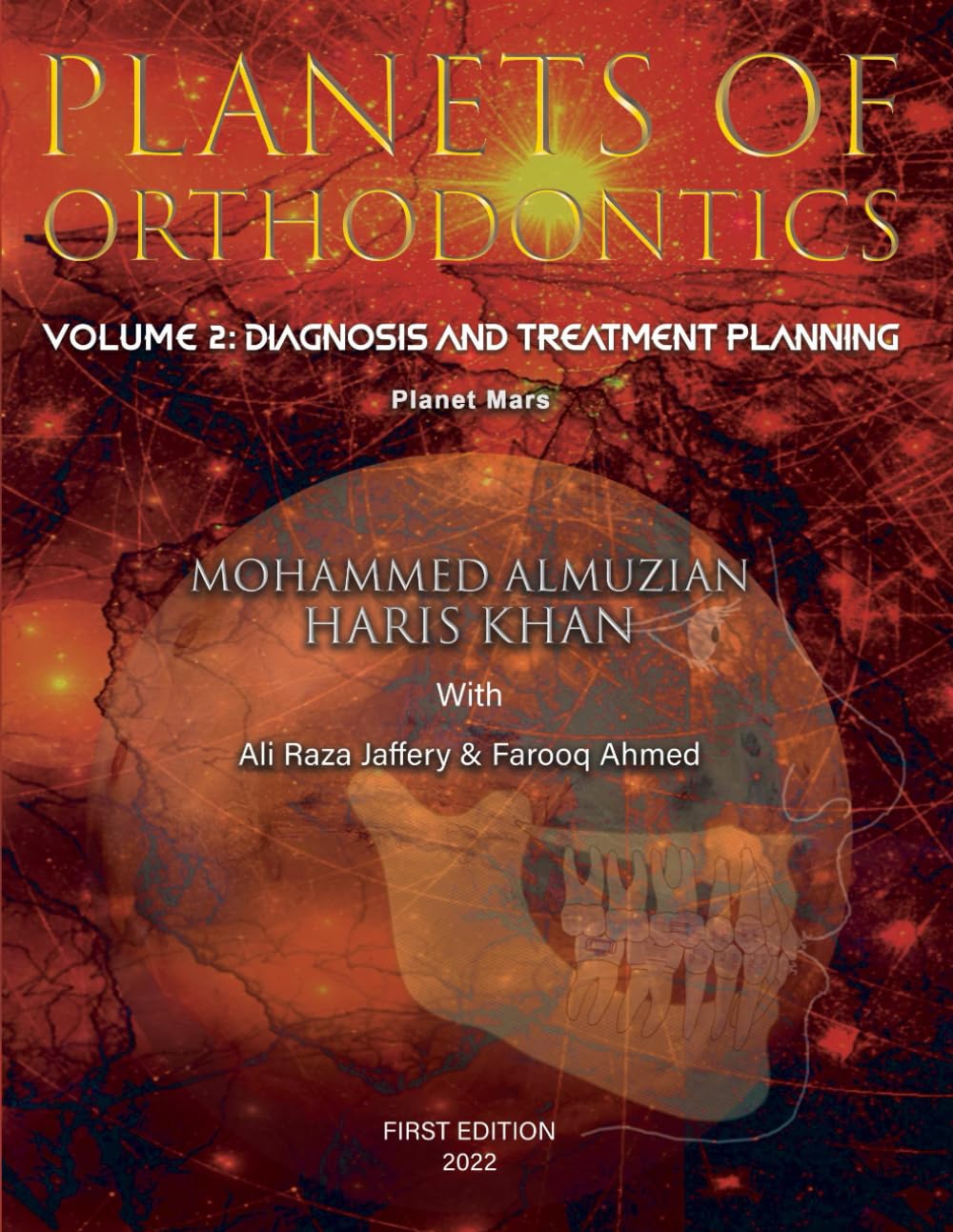 PLANETS OF ORTHODONTICS: Diagnosis and Treatment Planing: Volume 2/ Planet Mars