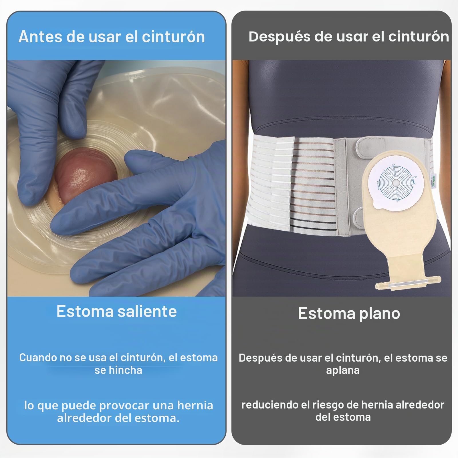 Faja Para Colostomía Para Hombre Y Mujer, Cinturón De Soporte Para Estoma Ajustable, Banda Cirugía Abdominal Hernia, Suministros Para Ostomía, Cinturón Colostomía Accesorios, L