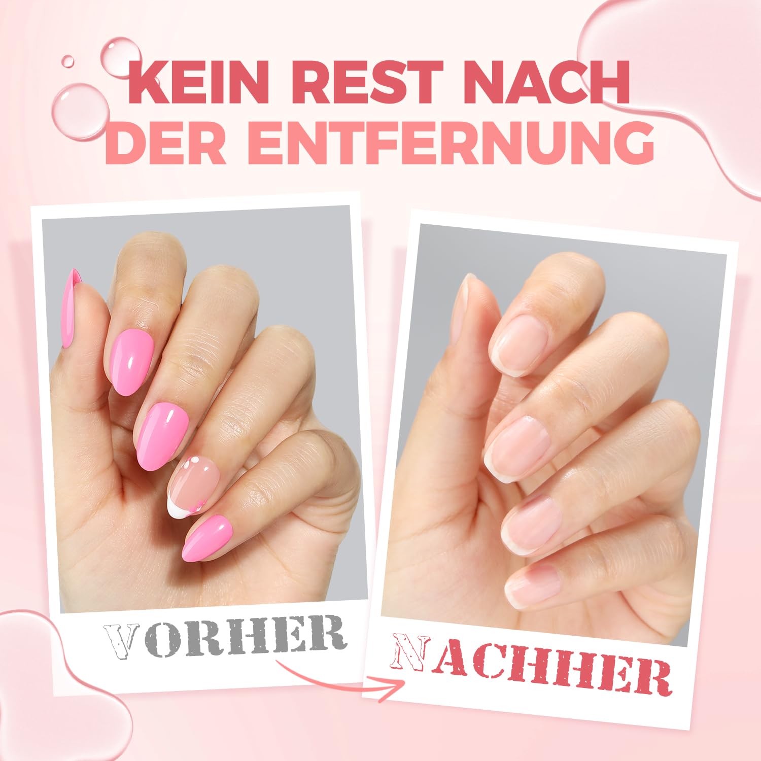 UNA GELLA Rimozione di colla per unghie Press On Nails, 30 ml, con leva integrata senza acetone, Soak Off per Nail Tip, colla fai da te (non per smalto gel UV)