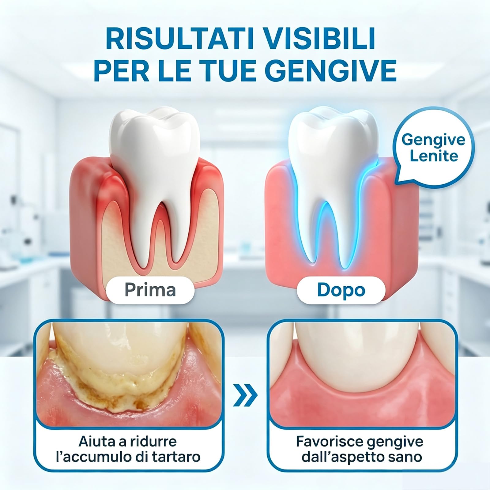 Glimmerly Gumrevive Gel Parodontale Rigenerante - 3 X 3 Ml/4Confezione | Sbiancamento Dentale Profondo, Gel Lenitivo Naturale Per La Protezione Delle Gengive, Sollievo Rapido, Alito Fresco