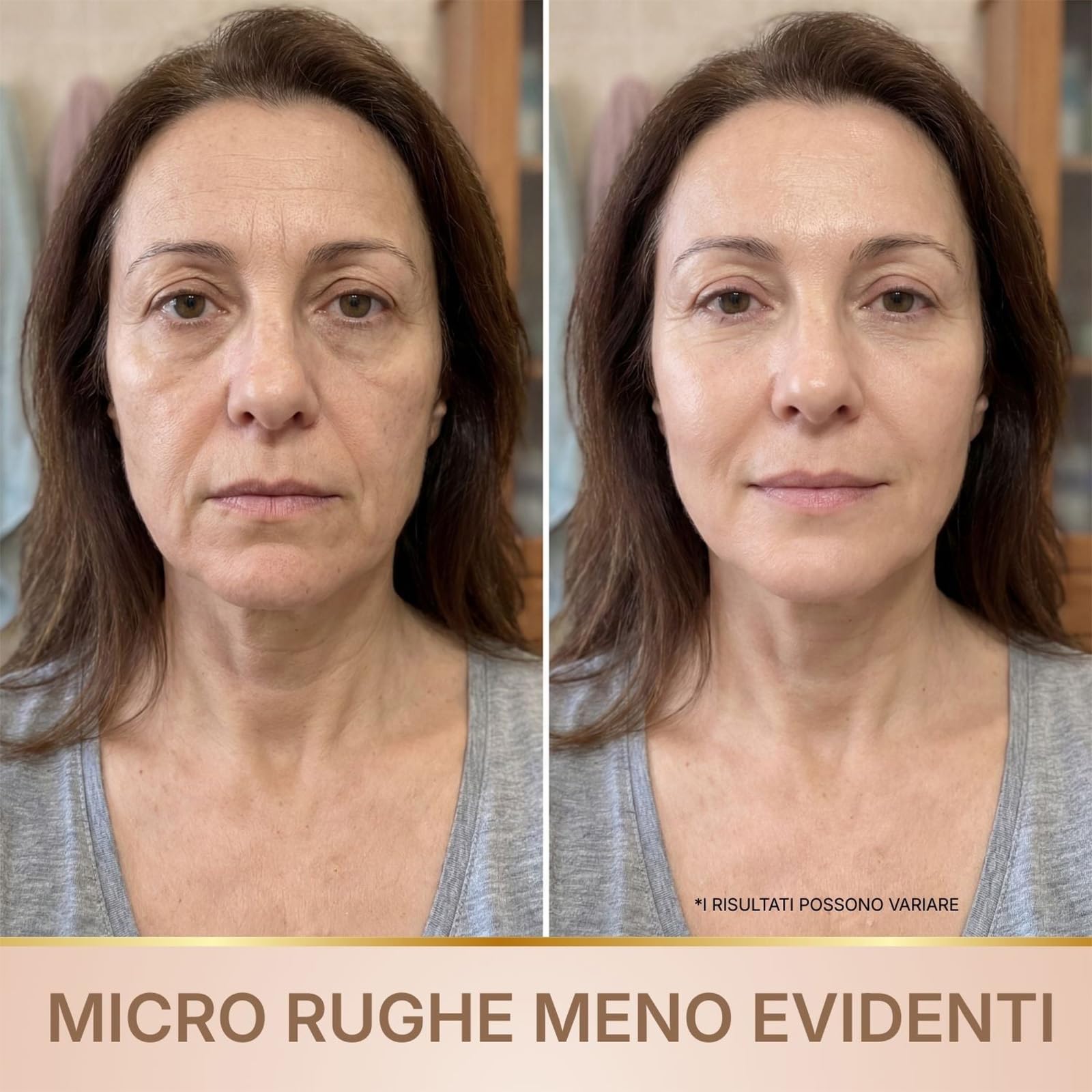 Biochroma Siero Coreano Effetto Lifting Dalla Prima Applicazione 2Pack, Siero Con Peptidi Di Seta E Collagene, Attenua Le Rughe, Idrata In Profondità, Consistenza Leggera 30 Ml
