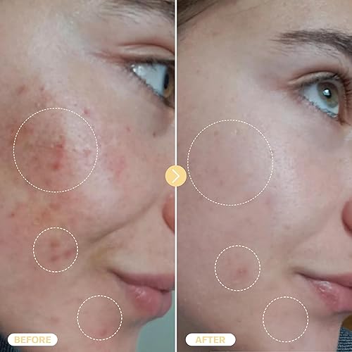 Miniatura 17 de BASE LABORATORIES Spray de ácido hipocloroso para cara y piel 8 onzas Spray facial Solución diaria de reparación de piel para pieles sensibles