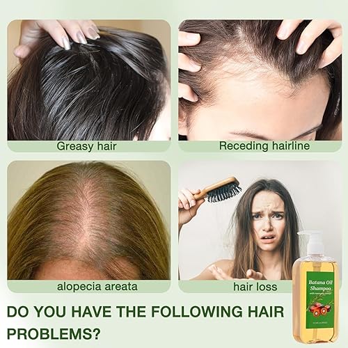 Miniatura 3 de Batana - Champú de aceite, romero y batana para crecimiento natural del cabello para adelgazar el cabello, pérdida de cabello orgánico para mujeres,