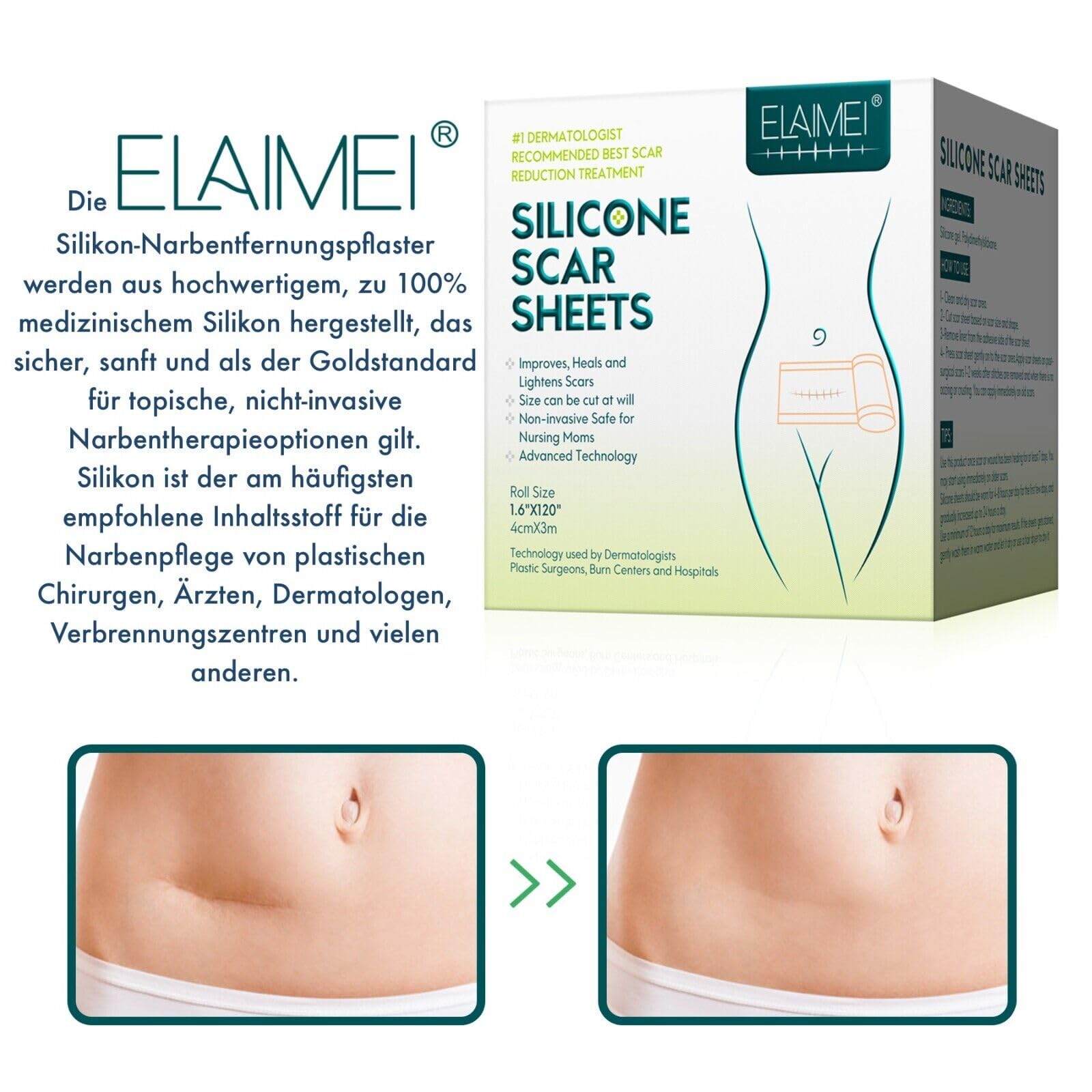 P-Beauty Silikonpflaster zur Narbenreduktion 4cm x 3,2m | Selbstklebendes, medizinisches Narbenpflaster | wiederverwendbar | gegen Akne, Keloid, OP & Verbrennungsnarben | Silikon Narbenrolle