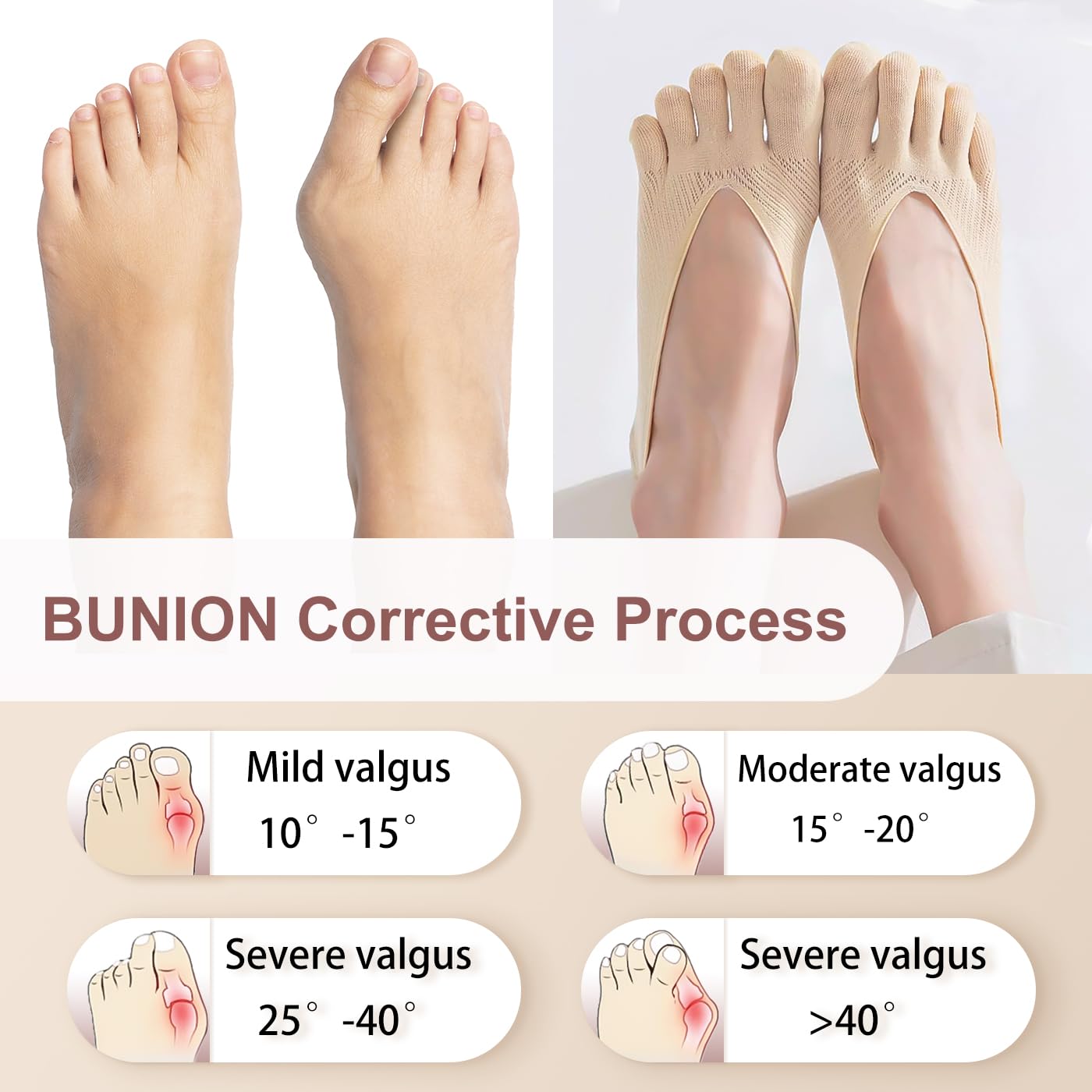 MoHern 6 Paar Zehensocken für Ballenzehen, Damen Fünf Finger Low Cut Sockalign USA Zehensocken, rutschfest und atmungsaktiv Ballenzeh-Korrektor