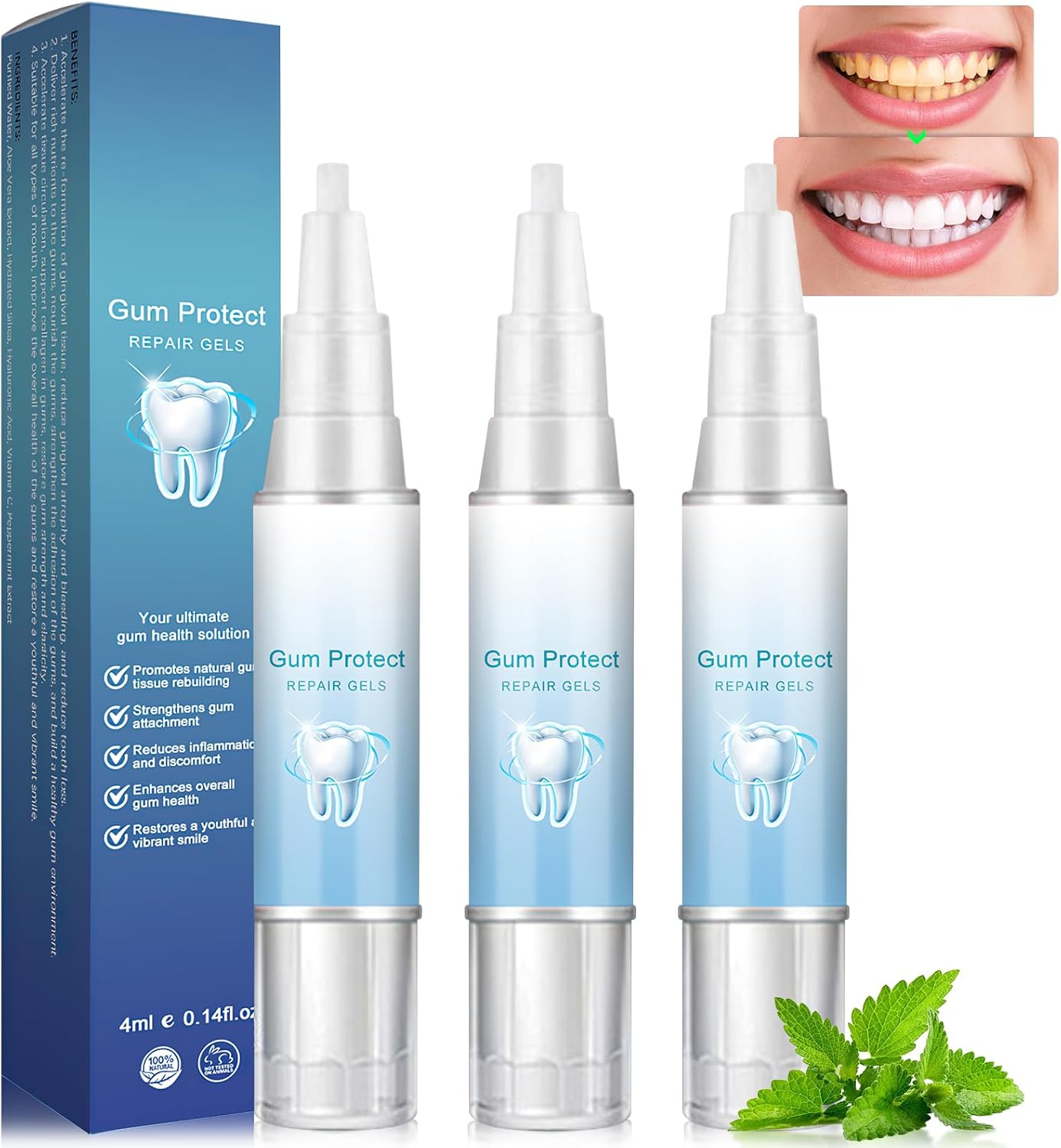 Neslemy Gum Gel,Neslemy Gum Shield Therapy Gel,Teeth