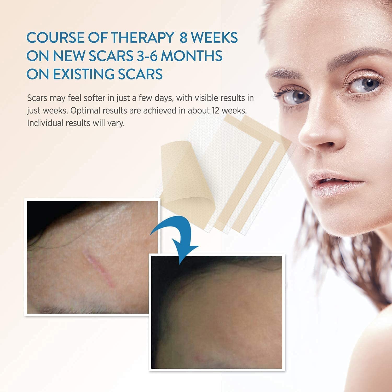 Aroamas Professional Silicone Scar Sheets, Soften and Flattens Scars