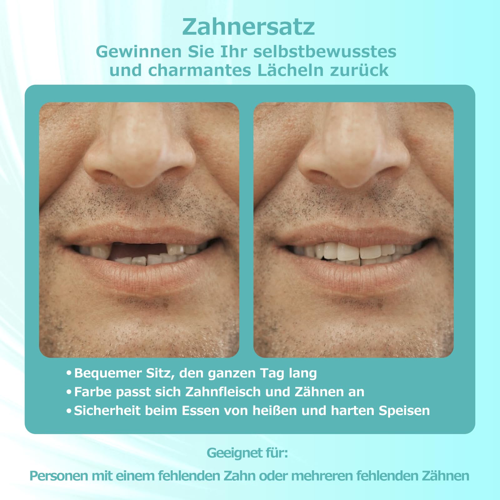 Prothèse Partielle Dentaire sur mesure - Dentier Provisoire, Prothese dentaire amovible et provisoire. Ajustement parfait et utilisation facile pour recréer votre sourire à domicile (3 dents)