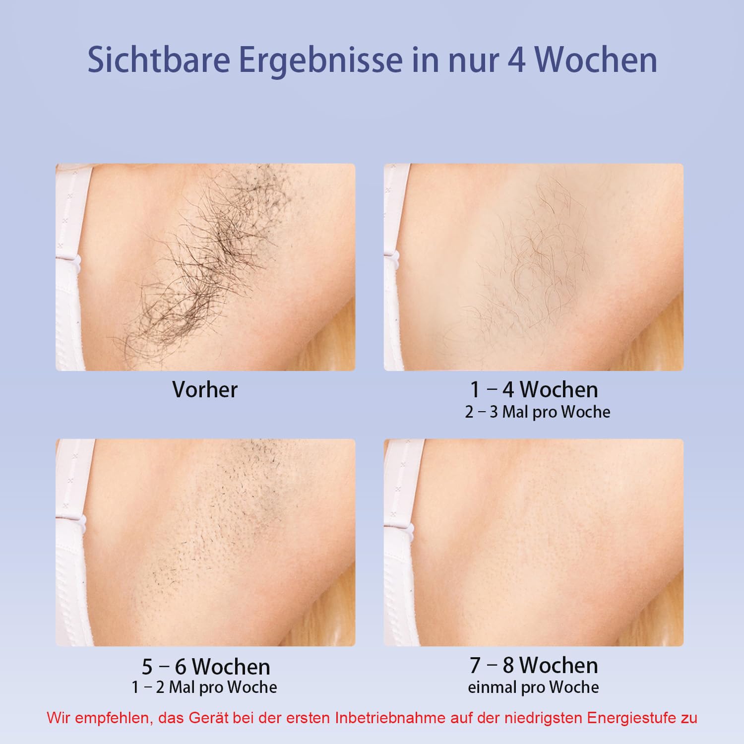 MLAY Laser IPL Geräte Haarentfernung - Leuchtet zweimal pro Sekunde auf 3-in-1 Kit Präzise Haarentfernung für jeden Teil Hair with Freezer Function Laser Hair Removal for Men, Women