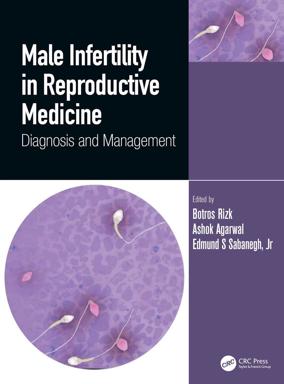Amazon.com: Male Infertility in Reproductive Medicine: Diagnosis and ...