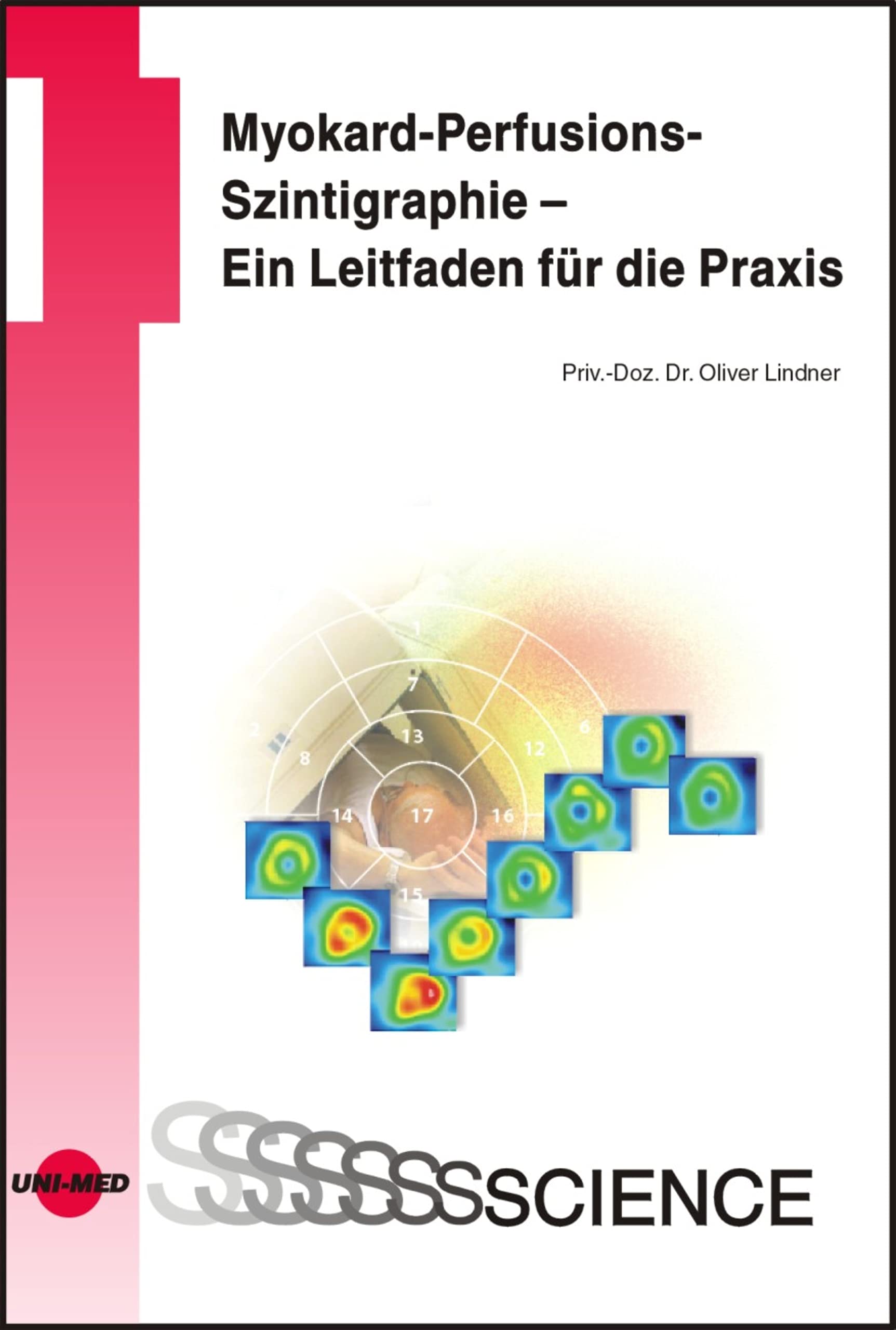 Myokard-Perfusions-Szintigraphie - Ein Leitfaden für die Praxis (UNI-MED Science)