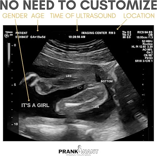 Miniatura 2 de Pranknant Imágenes de broma de ultrasonido falso  Tira 2D de 3 fotos  Sonograma de embarazo  Ultrasonido de embarazo de broma (gemelos)