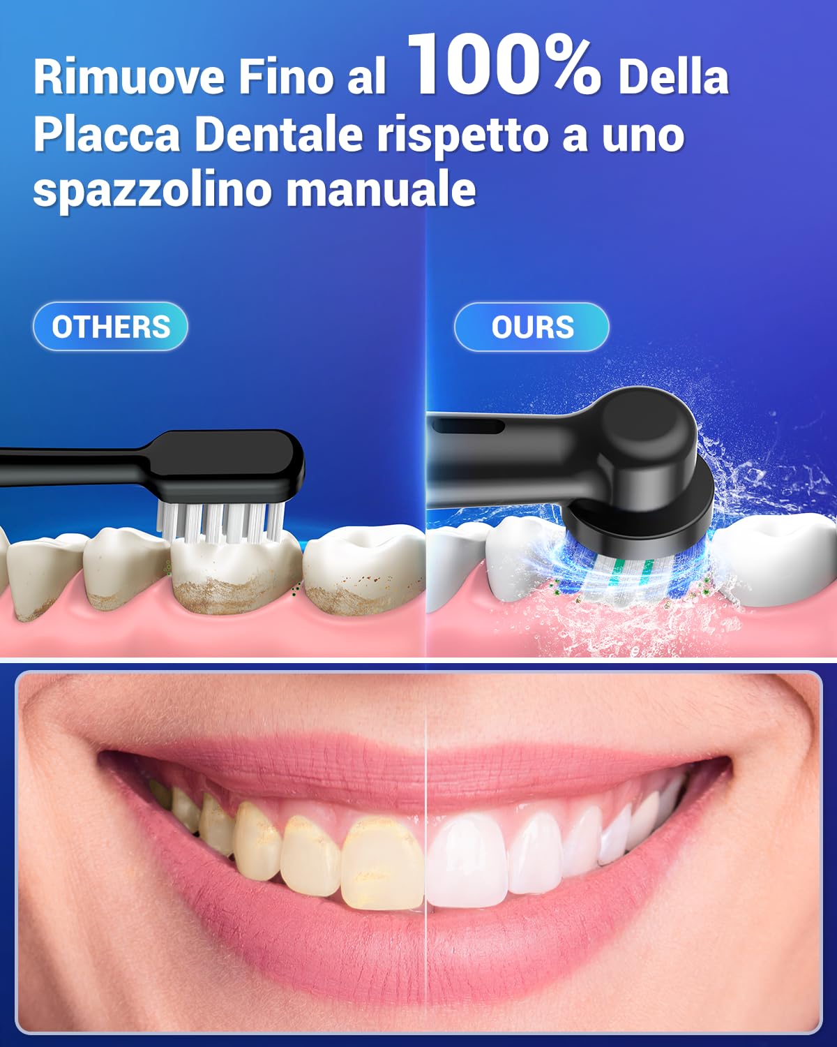 Spazzolino Elettrico Rotante per Adulti - 2 Spazzolino Denti Rotante con 10 Testine e 2 Custodia da Viaggio, 5 Modalità, Impermeabile IPX7, Spazzolino Elettrico da Viaggio Ricaricabile, Nero e Bianco