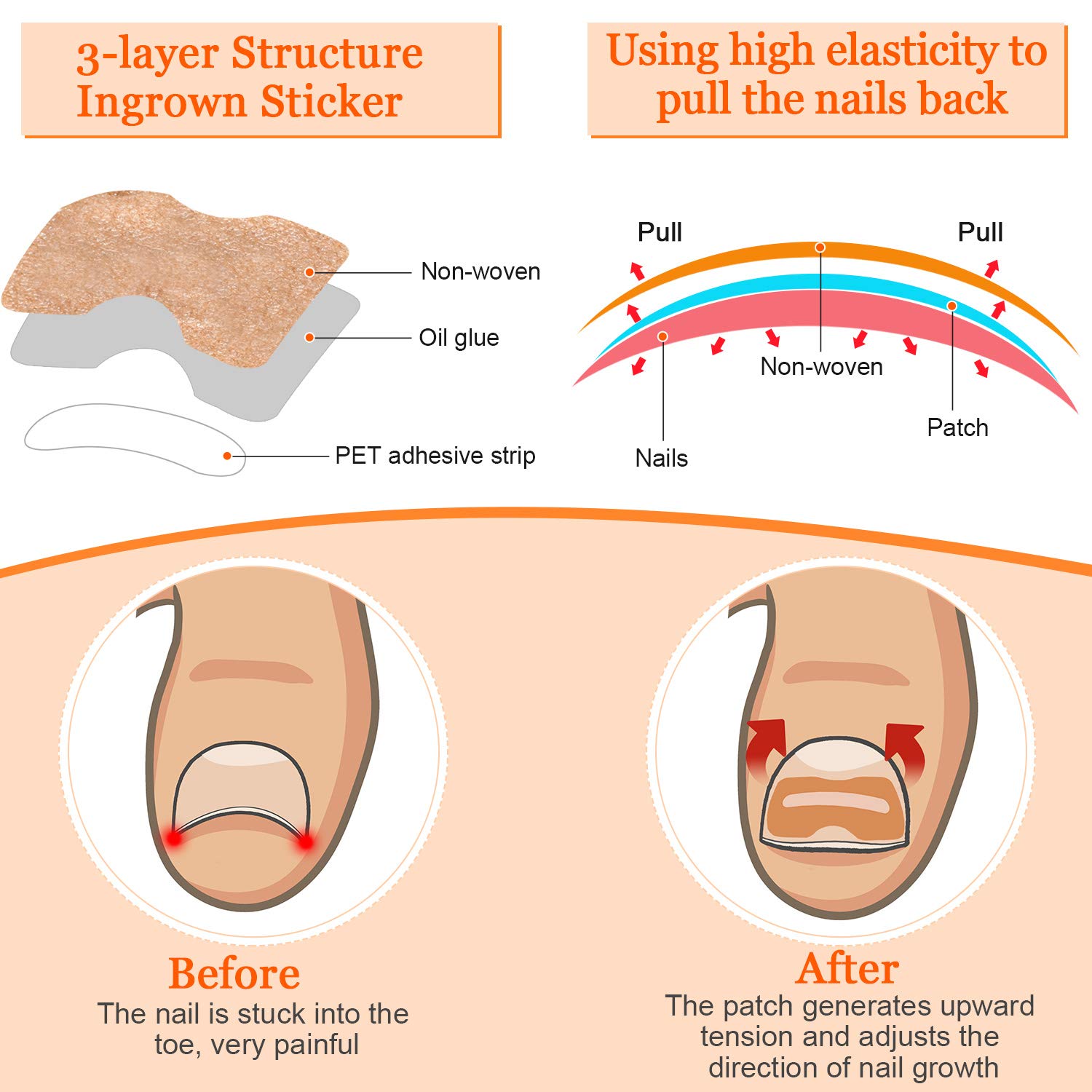 13 Pieces Ingrown Toenail Tools Kit, Includes Ingrown Toenail Lifter