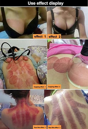 Miniatura 7 de WIKINK Masajeador de terapia al vacío, máquina multifuncional para moldear y raspar el cuerpo, 32 tazas, dispositivo de masaje corporal