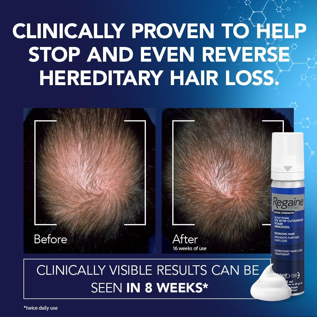 Regaine For Men Hair Regrowth Foam 3 x 73ml Nepal Ubuy