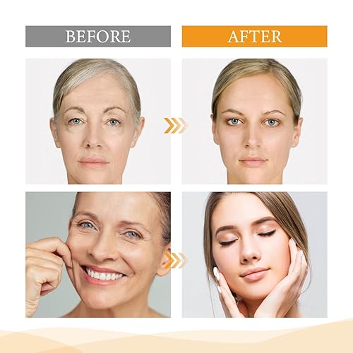 Miniatura 8 de Esencia ácida de fruta, solución de pelado AHA Esencia Líquida Exfoliante Poros Shrinks Facial Care Serum, extracto que contiene esencia de suero